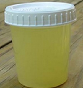 What are some causes of cloudy urine?