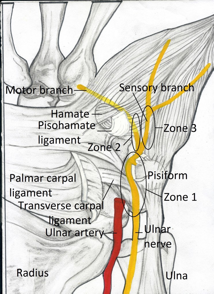 Guyon's canal anatomy picture