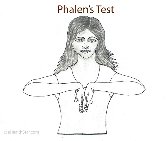 Picture of Phalen's Test, Sign