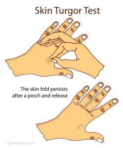 Picture of Skin Turgor Assessment