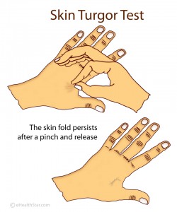 Picture of Skin Turgor Assessment