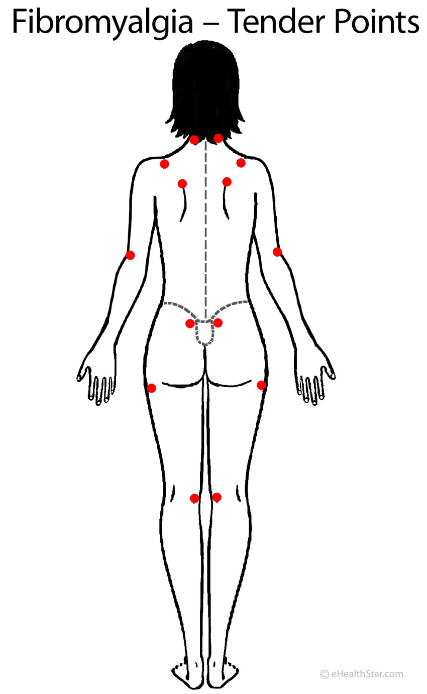 Shoulder Blade Pain: Left, Right or Under Scapula - eHealthStar