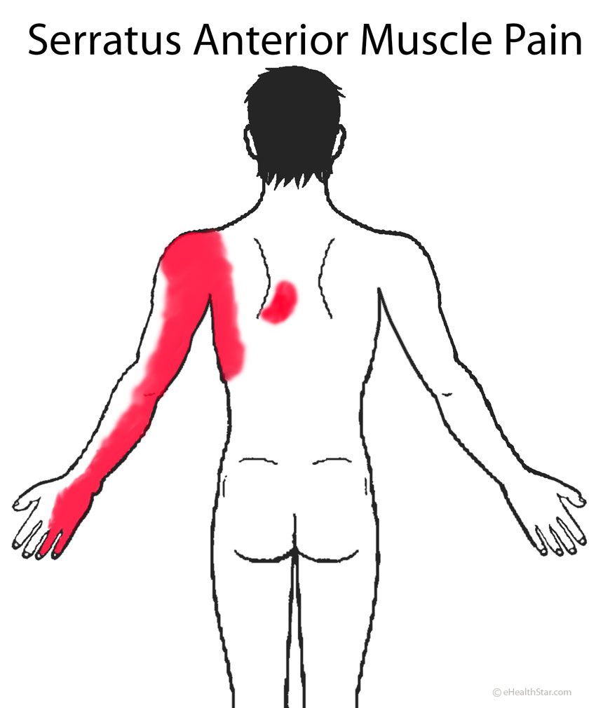Serratus Anterior Muscle Pain image